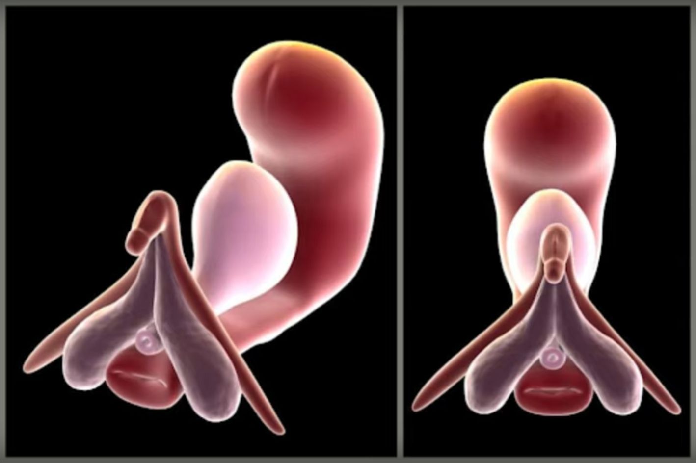 clitoris en 3 Dimensions